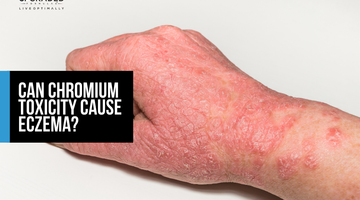 Can Chromium Toxicity Cause Eczema?