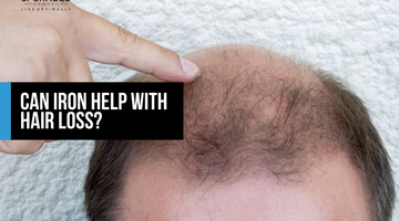 Can Iron Help With Hair Loss?