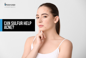 Can Sulfur Help Acne?