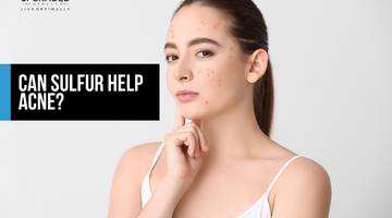 Can Sulfur Help Acne?