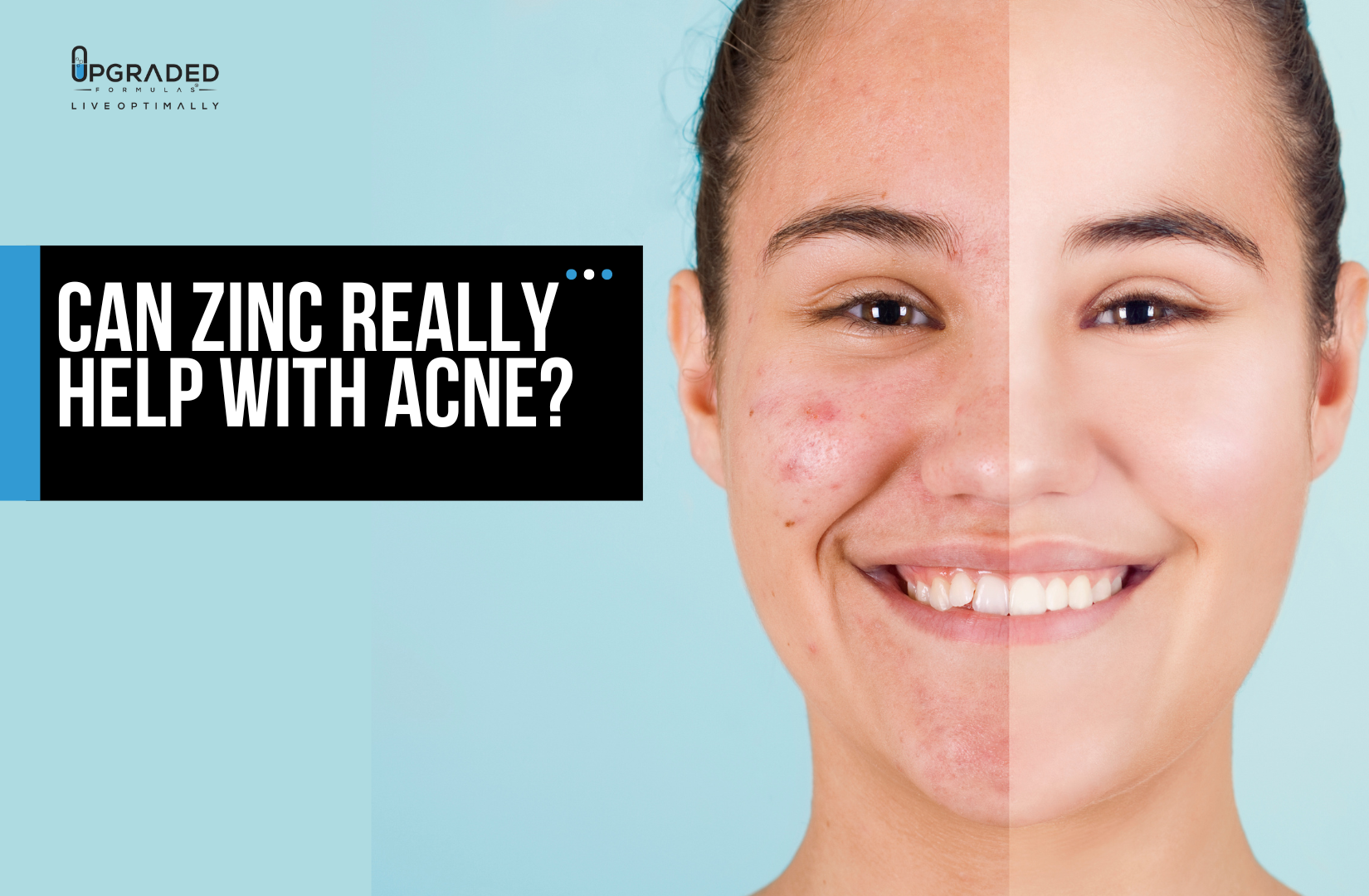 Can zinc really help with acne Upgraded Formulas
